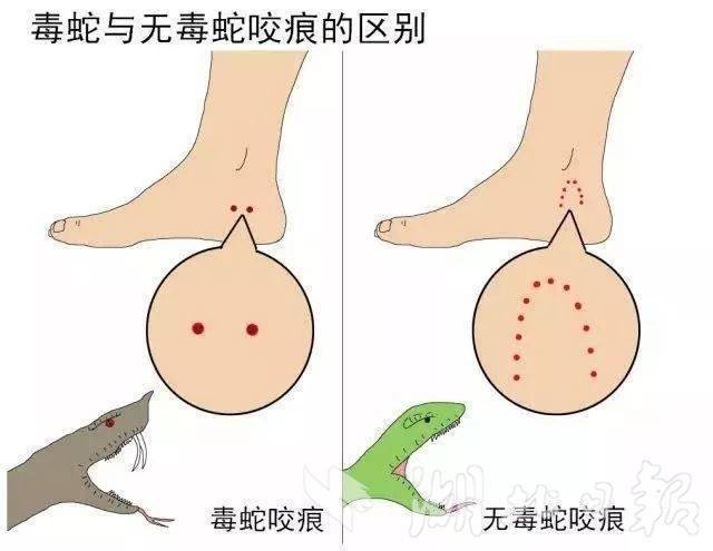 被毒蛇咬傷黃金救治時(shí)間約2小時(shí)