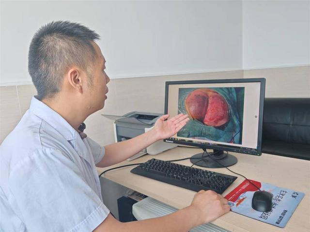 72歲老人坐石頭10秒屁股竟?fàn)C糊了 高溫天氣需警惕物表燙傷