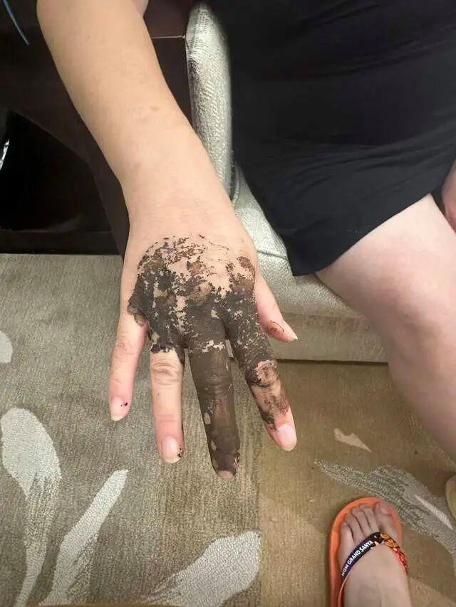 婆孙泳池边被毒虫咬伤索赔酒店遭拒 酒店态度强硬拒绝赔偿