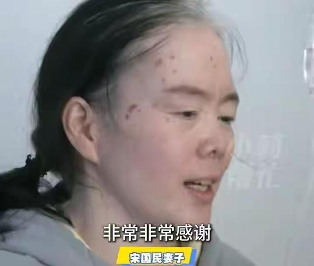 男子救人失去腿妻子拒绝所有捐款 自愿之事不求博爱