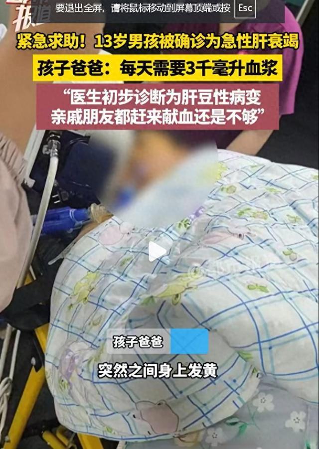 6岁男孩发烧后竟然“变色”了:警惕肝脏损伤信号