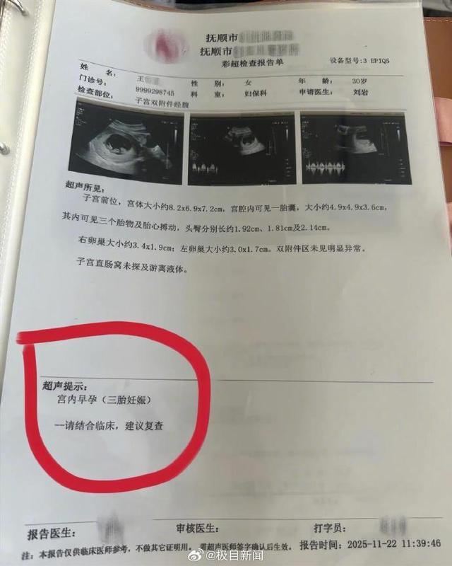 辽宁一孕妇两个月从一胎变四胞胎 罕见同卵四胞胎引发关注