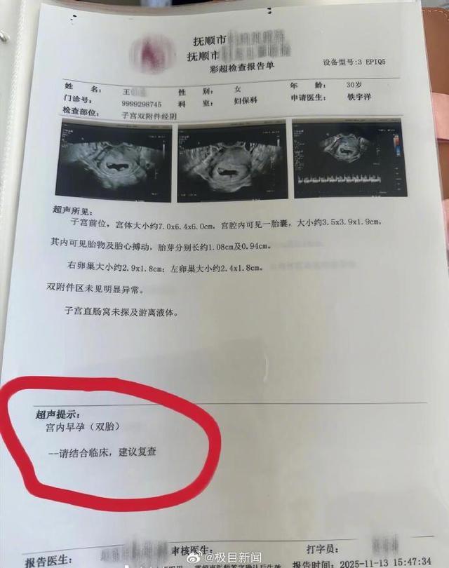 辽宁一孕妇两个月从一胎变四胞胎 罕见同卵四胞胎引发关注