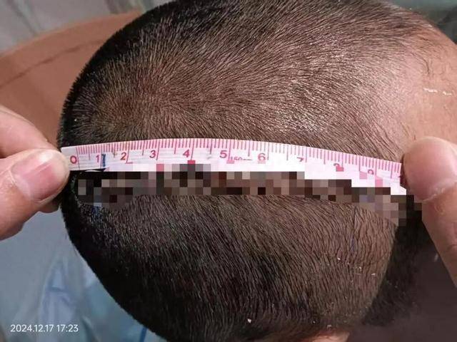 误会孙女被打爷爷重伤其同学获刑