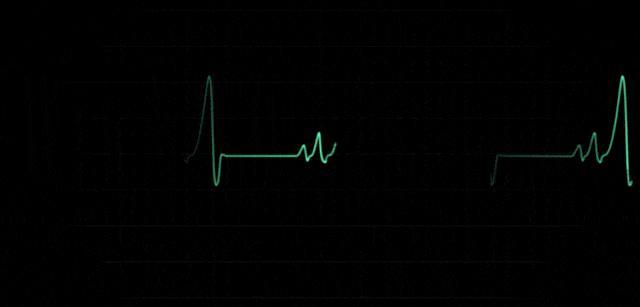 猝死前身体预警 警惕这些信号