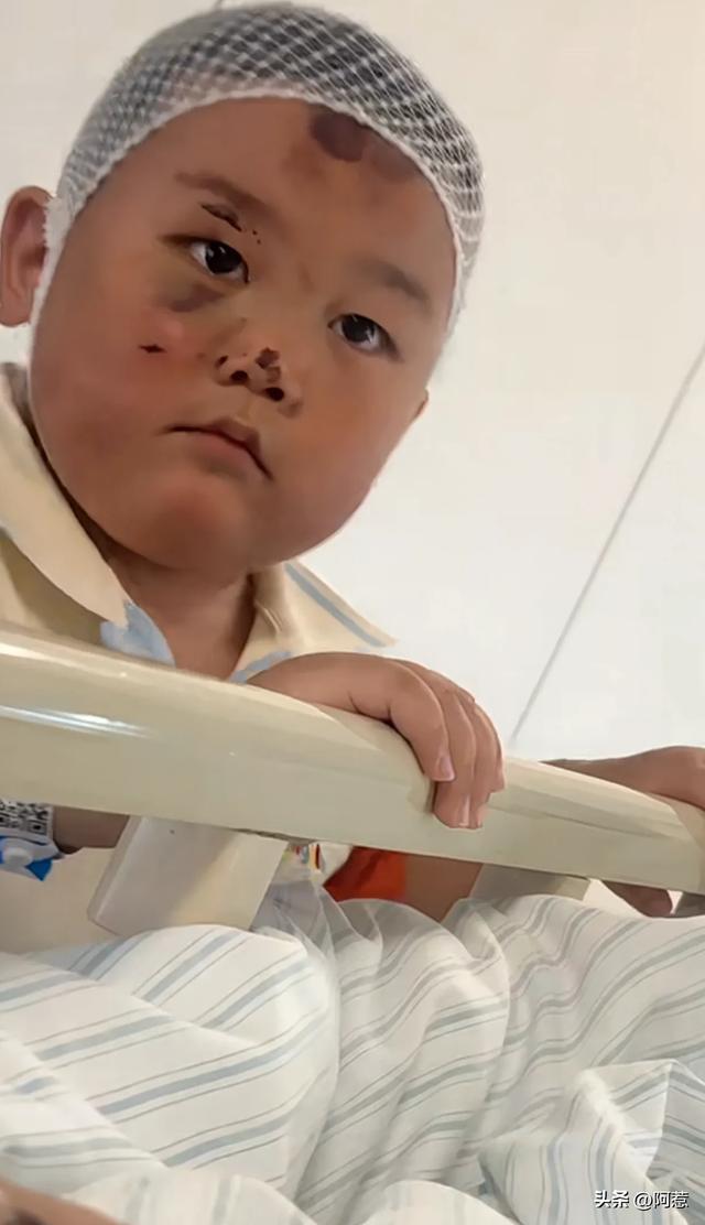 宝宝鼻青脸肿但眼神坚毅守着妈妈 小小男子汉的坚定守护