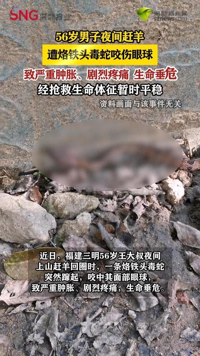 男子赶羊遭毒蛇咬伤眼球被送进ICU