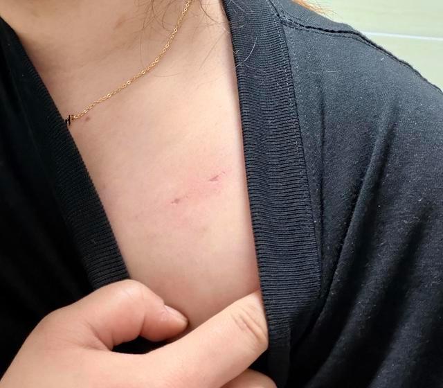 女子稱在家洗澡時一醉酒男子闖入試圖“猥褻”，警方立案偵查！