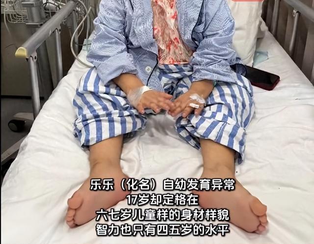 17岁女孩患罕见病样貌如六七岁