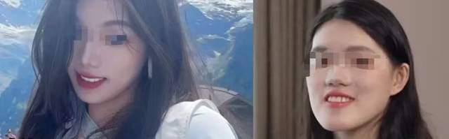 卫健委介入女子正颌事件