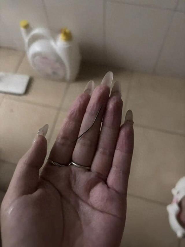 女子左臀疼1个月挤出发黑注射针头 意外发现引发热议