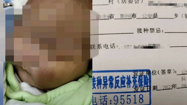 卫健委回应男婴打疫苗40小时后死亡
