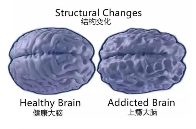 短视频正在“吃掉”孩子的大脑，但解决办法不是禁止