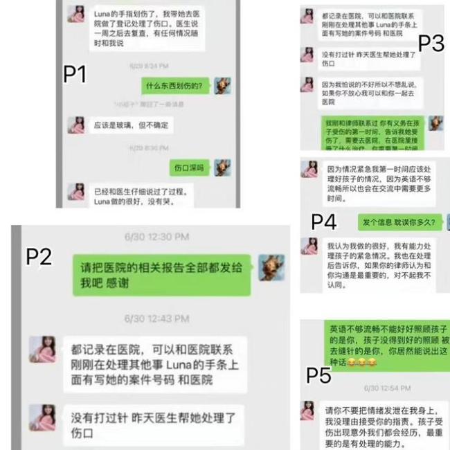 张恒起诉郑爽虐待一双儿女 晒视频图文曝孩子伤口
