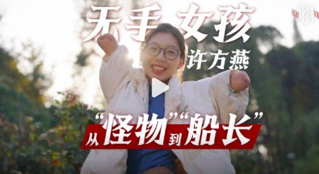 28岁无手女孩许方燕近况 