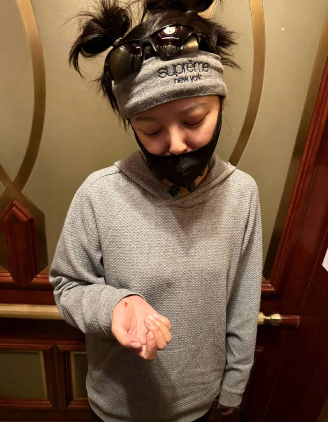 辛芷蕾晒自己的骑行照 自曝自己骑自行车摔倒受伤