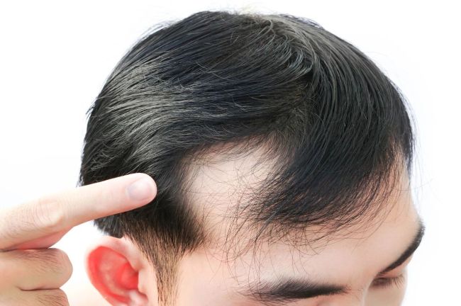 3.4亿“地中海”，撑起蔓迪国际IPO