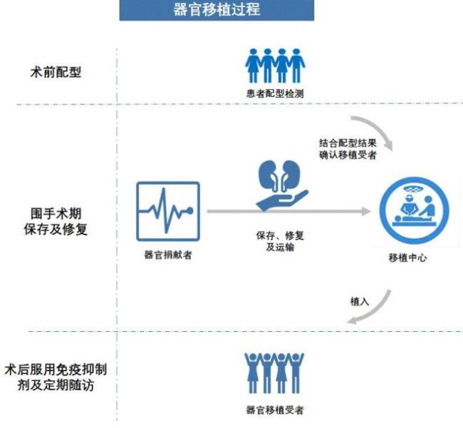 肾移植过程