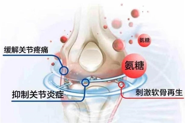 氨糖哪个牌子好？选择OTC氨糖，疗效确切、安全性好