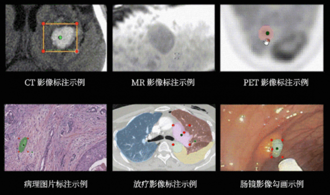 联影智能@CCR，多模态医疗大模型牵引医疗场景全新蝶变