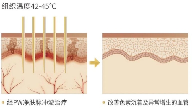 皮肤怎样“先修复后抗衰”？Sylfirm X黑曜双波：从基底膜带开始