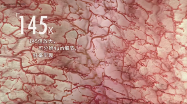 全球首创！科思明德145倍一键自动调焦光学放大内镜：秒级响应让医生专注发现病灶