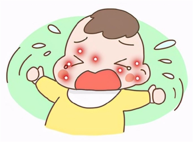 从宝宝过敏分级到精准选奶：适合湿疹体质喝的奶粉品牌全攻略