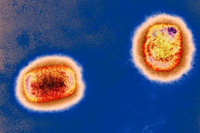 彩色透射电子显微捕获的猴痘病毒颗粒。图源：英国《新科学家》杂志网站