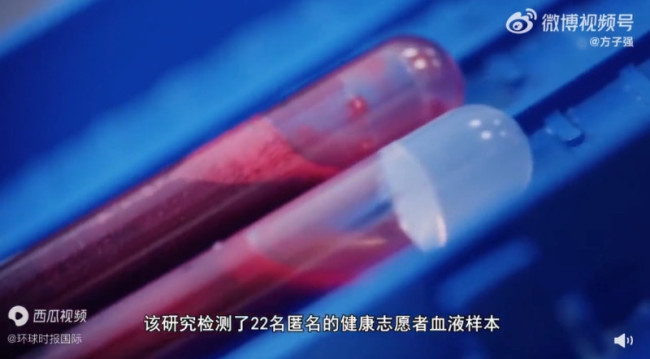 人类血栓中首次发现微塑料，通过血液渗透全身！