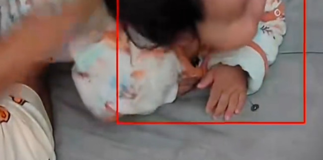 妈妈以为宝宝吐奶拍背后吐出图钉 医生：极其危险