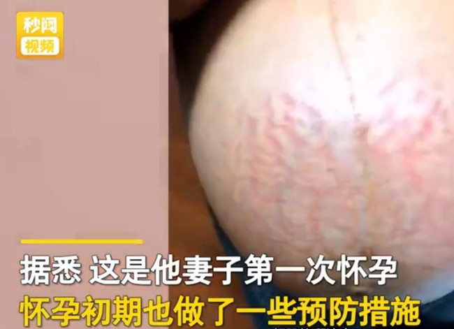 男子晒老婆孕肚狂吐槽恐怖