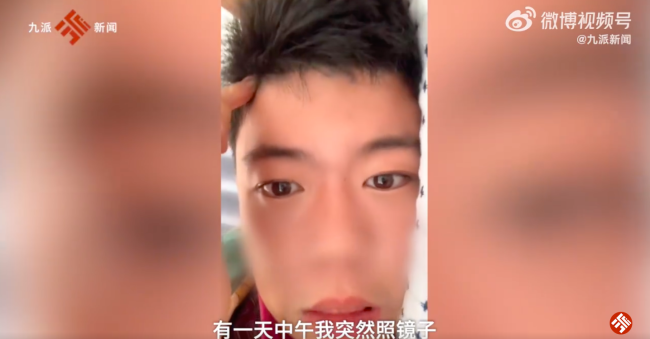 小伙阳后眉毛头发迅速增长