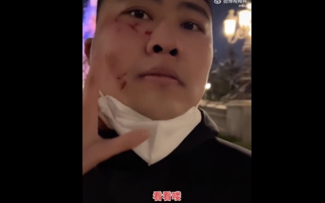 疑情侣迪士尼插队男子制止遭抓伤：插队者全程辱骂！