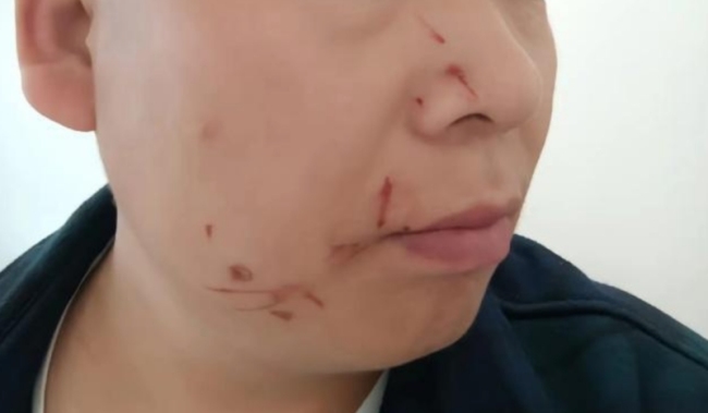 洪亮被迪丽热巴粉丝殴打
