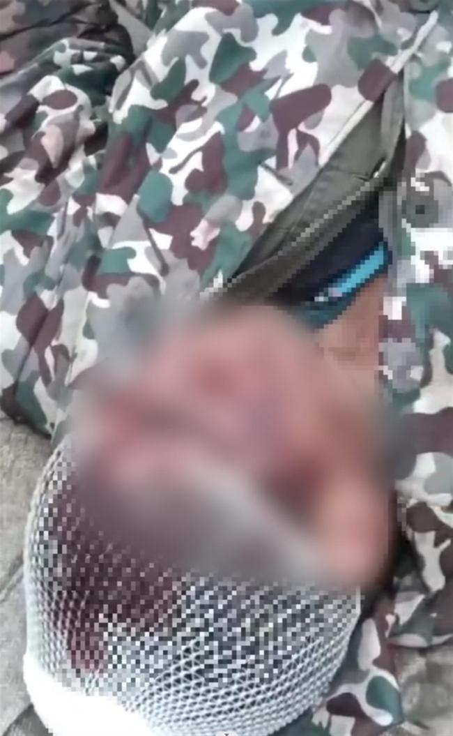 村民挖笋时与承包方起冲突多人受伤,对方使用了弯刀