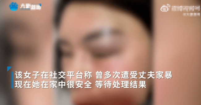 菏泽一女士自曝遭到家暴还被威胁 宠物狗柯基也被砍死