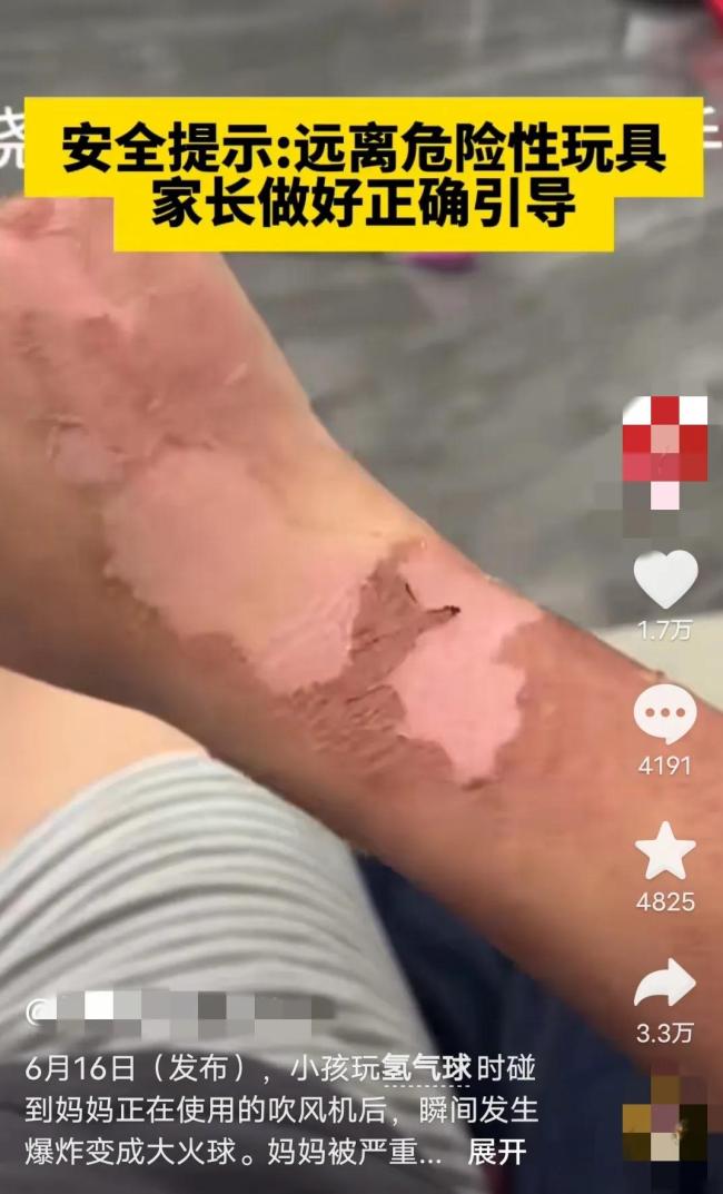 小孩玩气球爆炸女子被烧后跑开 为这事网友们不淡定了居然吵起来了！