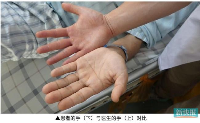 男子陪父亲看病反被诊出肿瘤 医生诊断"以貌取人"