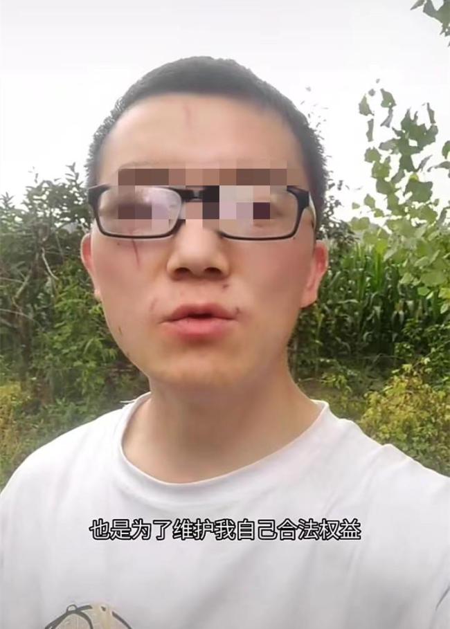 妇联谈小伙称被妻子家暴：等待官方核实情况