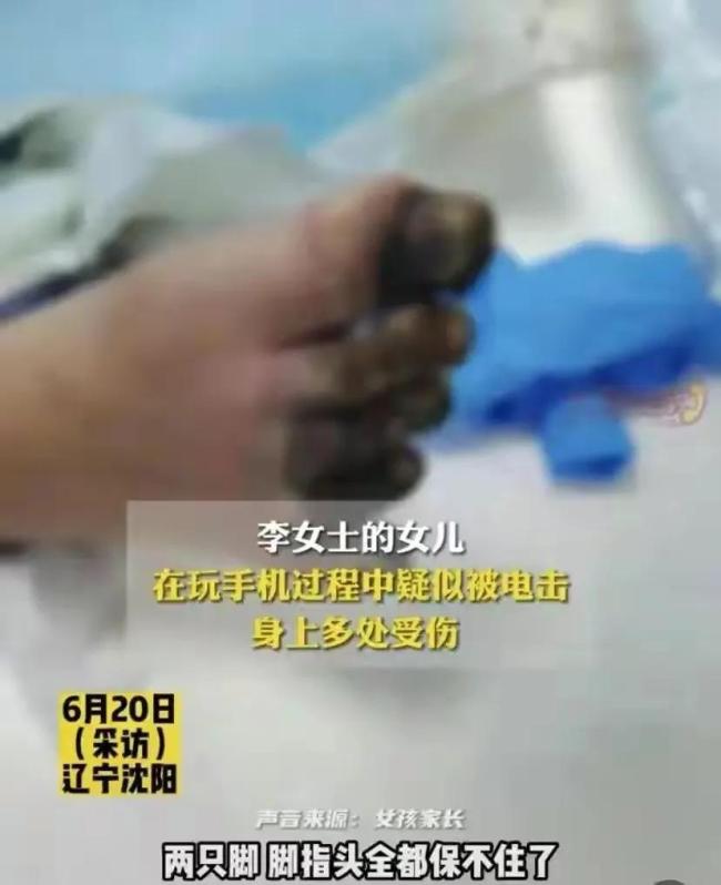 沈阳一女孩充电玩手机被电击，各脏器受损需要截肢