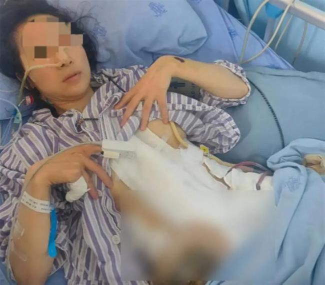 29岁女子被家暴16次致残 “这一次到医院时医生说已经没有脉搏了再晚到20分钟就救不活了”