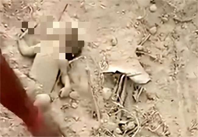 印度男婴被活埋9小时获救：逆袭命运！