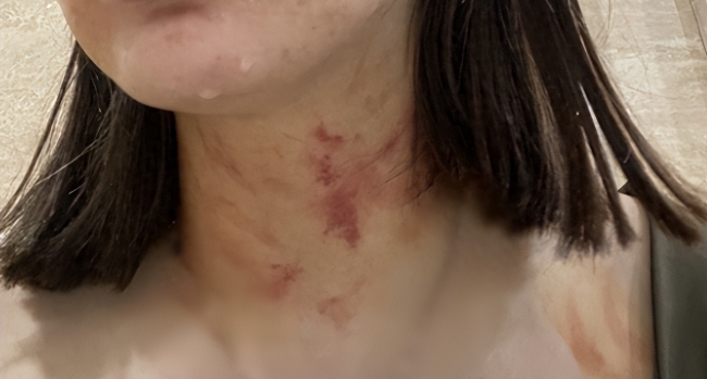 反转？自述牵狗进电梯被邻居殴打女生道歉：账号设私密 主页发布致歉文本