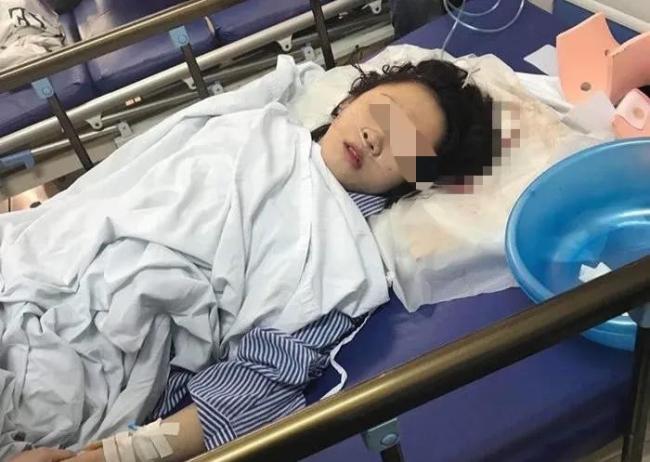 20岁大学生上课时突发脑梗昏迷不醒 送医后取栓获救