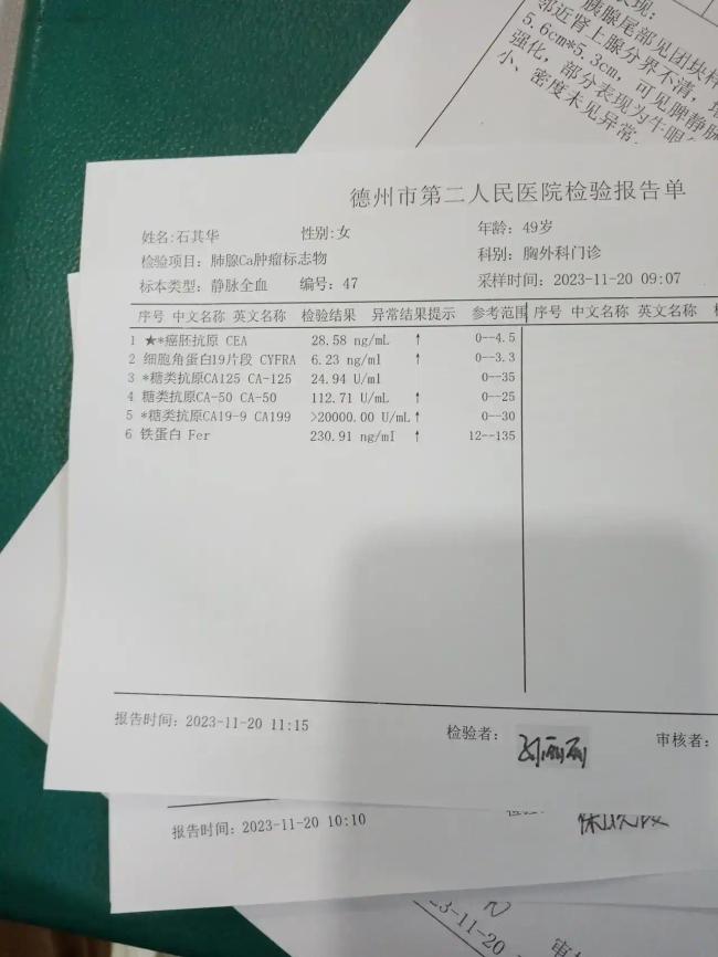 女子查出胰腺癌不想花钱受罪用坚强与乐观迎战病魔