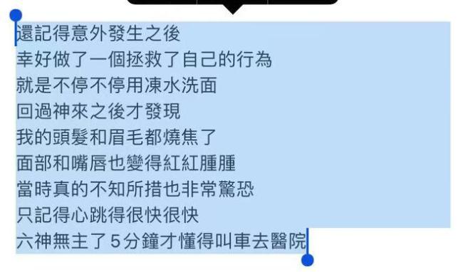 港星关智斌自曝煤气漏气致面部手部二级烧伤