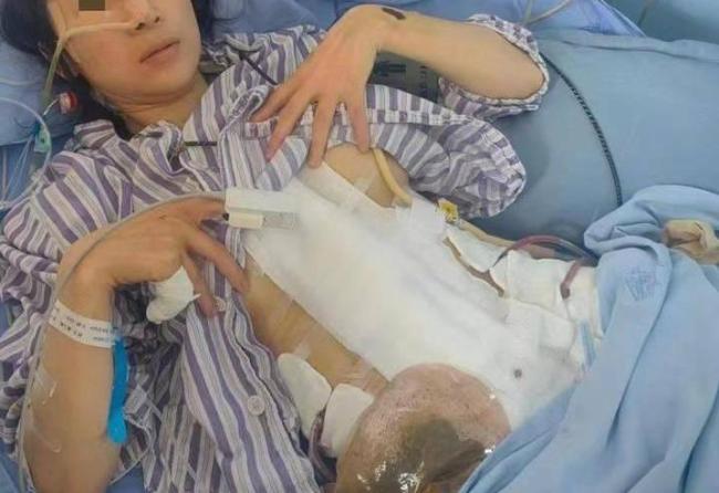 女子2年被家暴16次致4个重伤二级 望施暴者获死刑