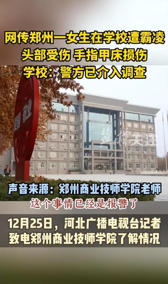 网传河南一女生遭多人霸凌指甲被打脱落 学校称警方已介入调查