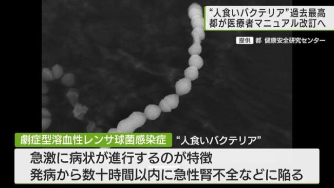 致死率超30%！罕见“食人菌”席卷全日本 今年前两月已出现超400例