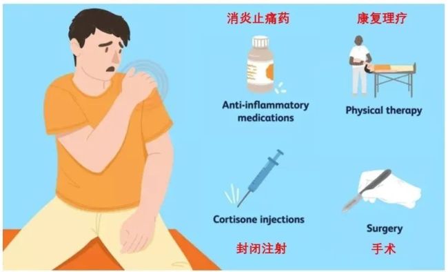 肩膀“冻住了”，如何快速“解冻”？